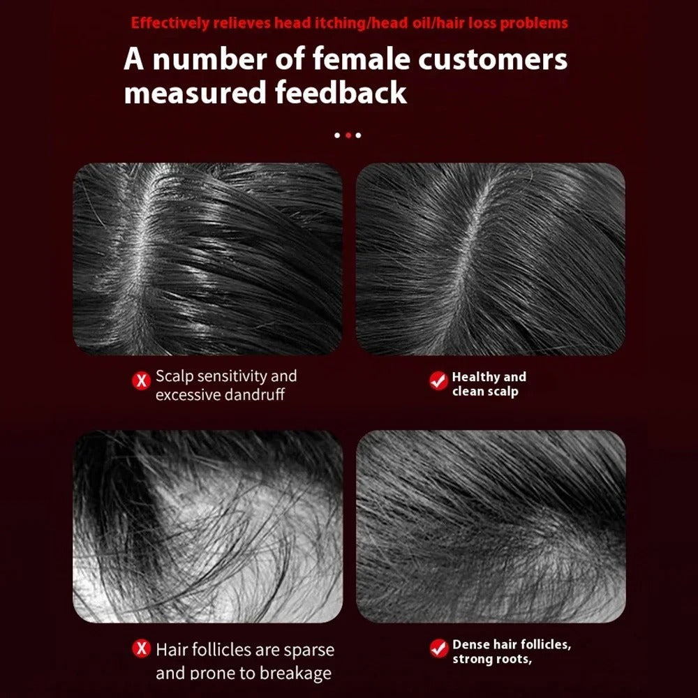 Hair Growth Massager Comb | 630nm Infrared Light + Scalp Oil Applicator | Anti-Hair Loss Solution