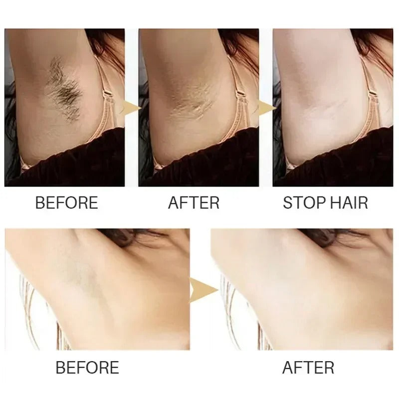 Painless Hair Removal Spray | Powerful Epilator Cream & Growth Inhibitor for Body & Intimate Areas